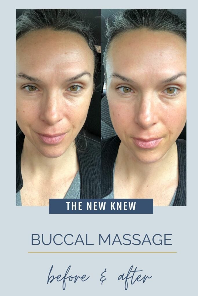 before and after a buccal massage.