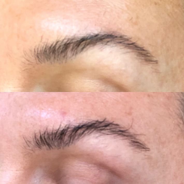 Lisa's before and after photos, lash and brow serum.