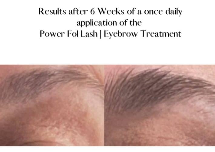 before and after using lash and brow serum 3