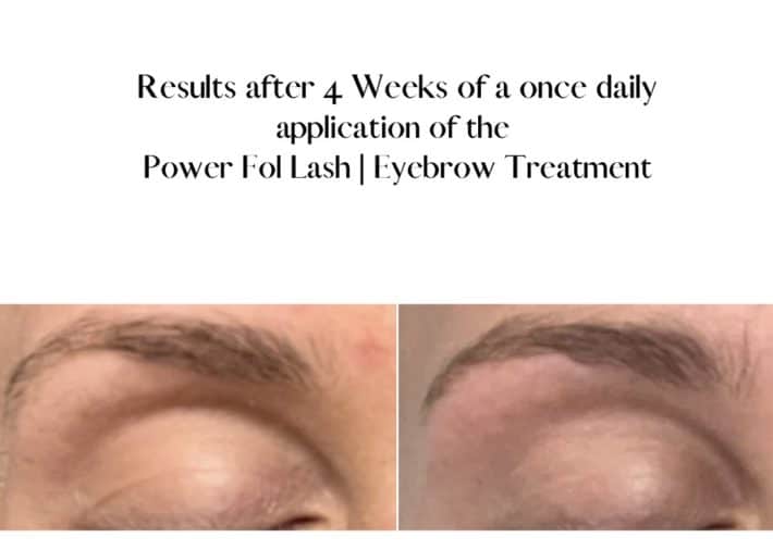 before and after using lash and brow serum 2