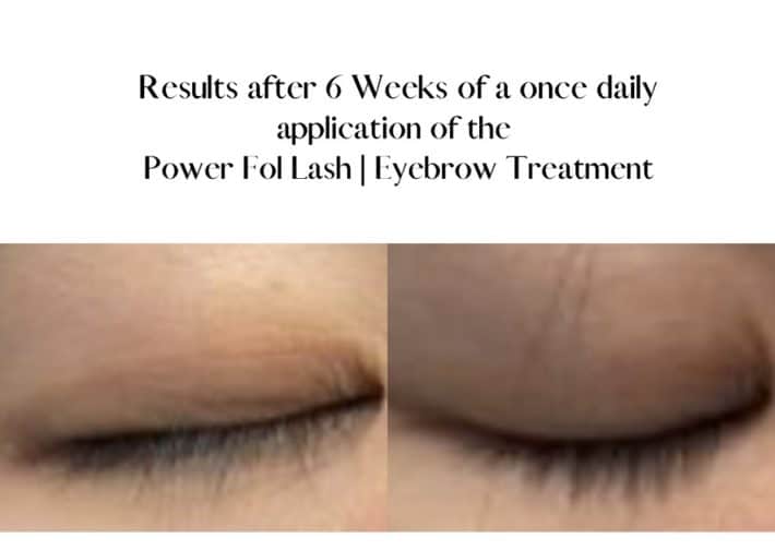 before and after using lash and brow serum 4