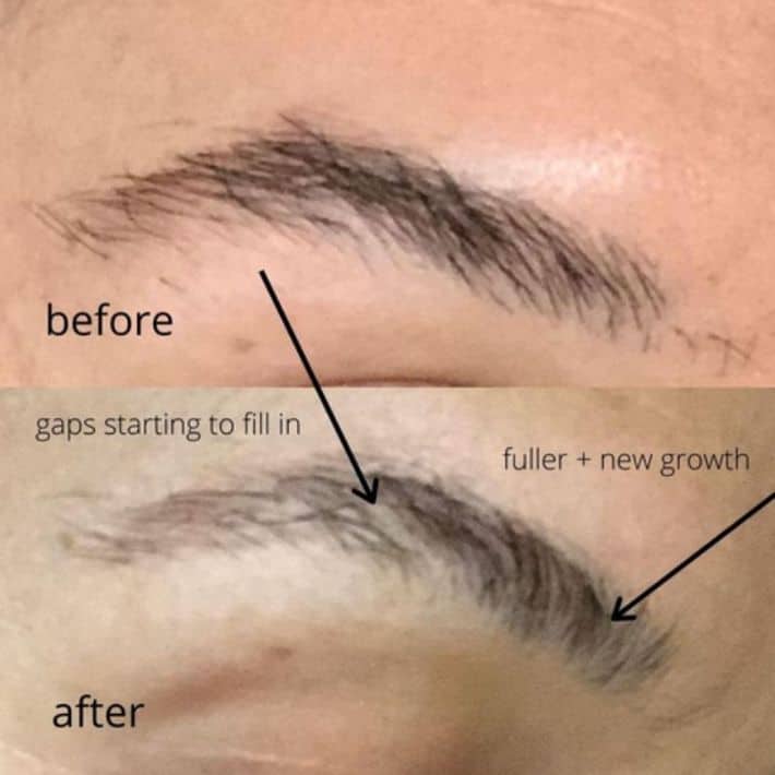 Before and after using Papillon eyebrow serum.