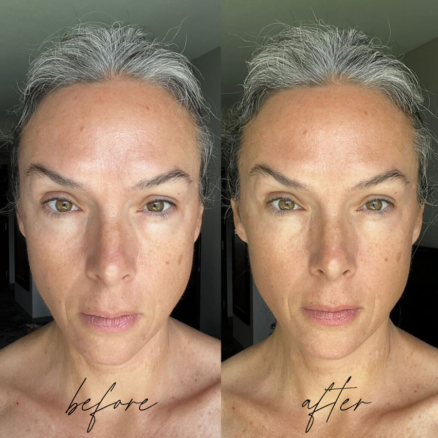 side by side before and after images of a woman who tried Solawave's 4 in 1 Wand.